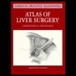 Atlas of Liver Surgery