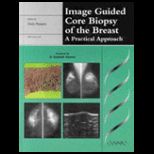 Image Guided Core Biopsy of the Breast