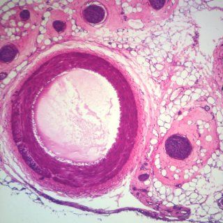 Mammal Artery & Vein c.s. 7 µm H&E Microscope Slide