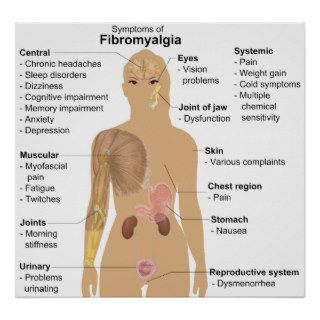 Chart of the Symptoms of Fibromyalgia Posters