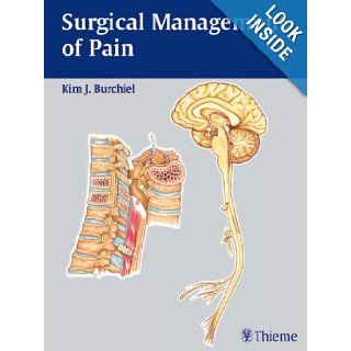 Surgical Management of Pain Kim J. Burchiel 9783131259813 Books