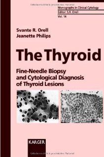 The Thyroid Fine Needle Biopsy and Cytological Diagnosis of Thyroid Lesions (Monographs in Clinical Cytology) (9783805563833) Svante R. Orell, Jeanette Philips Books