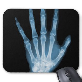 Blue X ray Skeleton Hand Mousepad