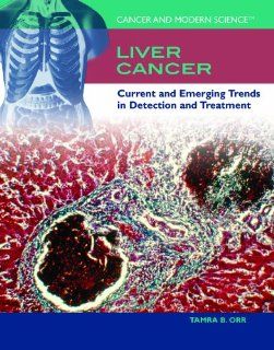Liver Cancer Current and Emerging Trends in Detection and Treatment (Cancer and Modern Science) (9781435850095) Tamra B. Orr Books