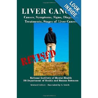 Liver Cancer Causes, Symptoms, Signs, Diagnosis, Treatments, Stages of Liver Cancer   Revised Edition   Illustrated by S. Smith Department of Health and Human Services, National Institutes of Health, S. Smith 9781470019402 Books