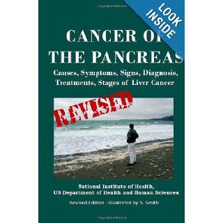 Cancer Of The Pancreas Causes, Symptoms, Signs, Diagnosis, Treatments, Stages of Pancreatic Cancer U.S. Department Of Health And Human Services, National Institutes of Health, National Cancer Institute, S. Smith 9781475010244 Books