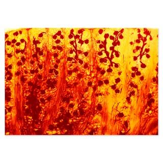 Kidney filtering units, light micrograph   Invitations by sciencephotos
