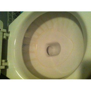 Pumie Toilet Bowl Ring Remover #TBR 6
