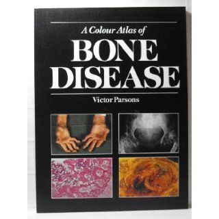 A Colour Atlas of Bone Disease Victor Parsons 9780723416029 Books