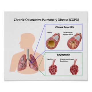 Lung disease (COPD) Poster