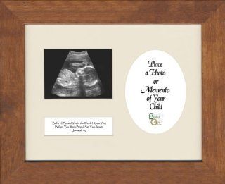 Sonogram Child Ultrasound Baby Photo Picture Frame 9" X 11" with Wall Hangers   Single Frames