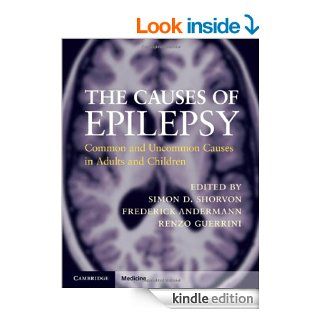 The Causes of Epilepsy (Cambridge Medicine)   Kindle edition by Simon D. Shorvon, Frederick Andermann, Renzo Guerrini. Professional & Technical Kindle eBooks @ .