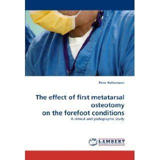 The effect of first metatarsal osteotomy on the forefoot conditions A clinical and pedographic study Peter Kellermann 9783843394482 Books