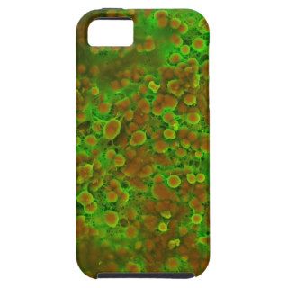 Cardiovascular Calcification Microscopic Close Up iPhone 5 Cover