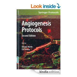 Tumour Angiogenesis and chemotherapy eBook Anser Ali Kindle Store